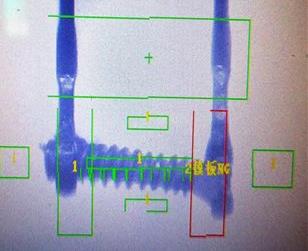 保险丝焊接缺陷检测